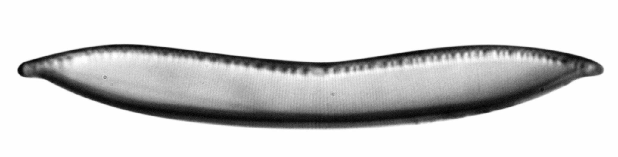 Alcuni magnifici frustuli di diatomee osservati al microscopio Cymbella cistula Didymosphenia geminata Hantzschia