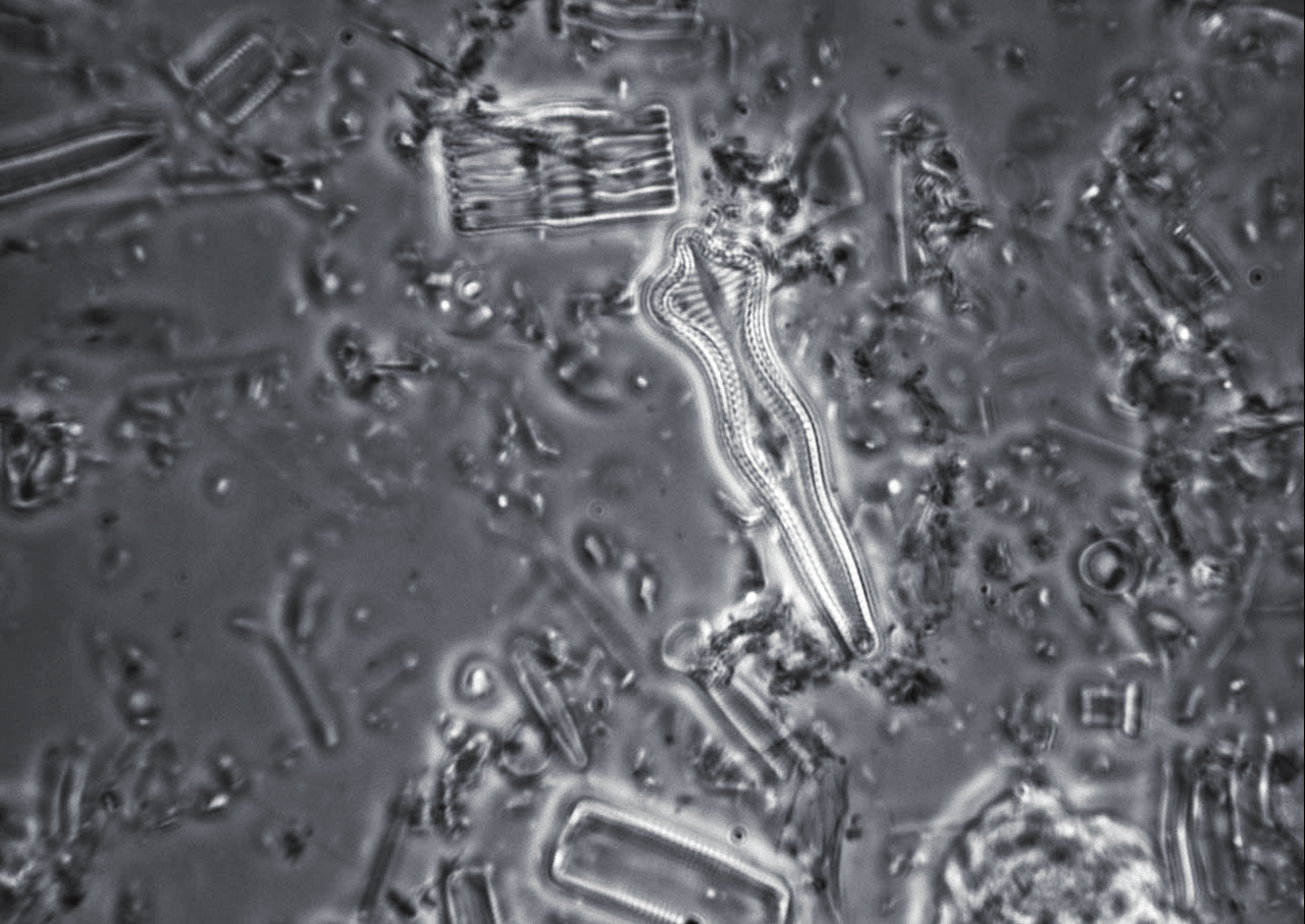 IL FRUSTULO EVANESCENTE DELLE DIATOMEE Ci occuperemo ora dell osservazione del frustulo di queste straordinarie alghe dopo il lavaggio per l eliminazione del protoplasma cellulare.