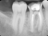 PROFILO DELL AUTORE. Il Dr. Steven Cohen è istruttore clinico nel Post Graduate Endodontics all università di Toronto, Faculty of Dentistry.