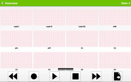 Multitracciato Il software di controllo consente la visualizzazione in tempo reale di fino a 12 tracciati e una autodiagnosi