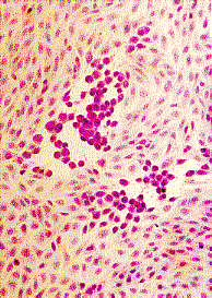 Effetto citopatico in cellule in coltura.