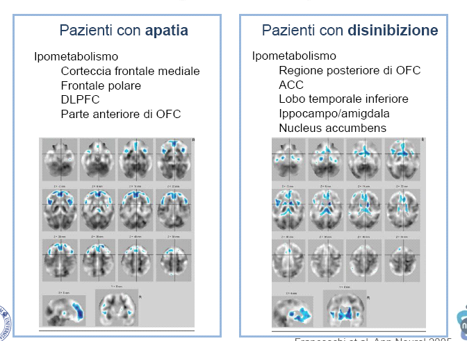 Evidenze neuroimaging funzionale: