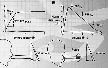 Fig.1 La spirometria, quindi, è cruciale per identificare l ostruzione al flusso aereo e monitorare la risposta alla terapia e l andamento della malattia.