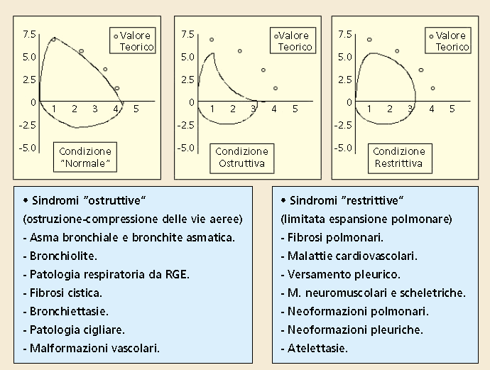 Pattern ventilatorio delle malattie toraco-polmonare STEP 4 Grave- Persistente STEP 3 Moderato-Persistente STEP 2 Lieve-Persistente STEP 1 Intermittente Classificazione di gravità SINTOMI SINTOMI