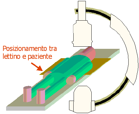 Le pellicole irradiate sono state lette seguendo il protocollo ISP [2] e analizzate con un programma realizzato utilizzando l ambiente di calcolo Matlab [3], che applica la calibrazione Pixel-Value