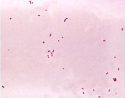 Aspetti eziologici Neisseria meningitidis Forme intracellulari [Diplococcus intracellularis (Weichselbaum A, 1887)] Forme extracellulari Capsula: