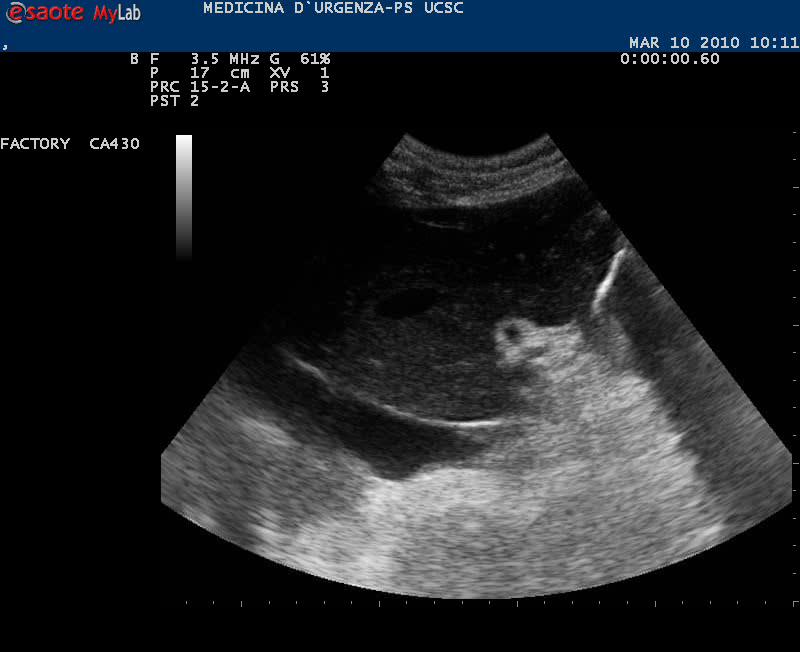 SCANSIONI FONDAMENTALI Epigastric and other scans