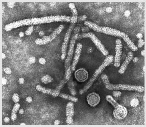 HCV: Progressione e Cofattori Cirrosi Morte Epatite Cronica HCC Fattori dell