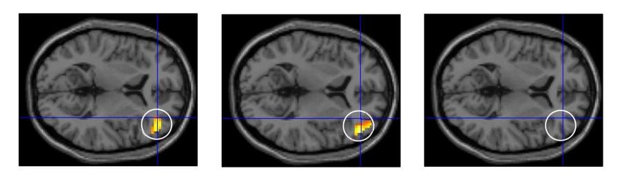 Reward Probabilistic Reversal Learning Task Less activation Ventro lateral prefrontal cortex Controls Smokers Problem Gamblers Reward