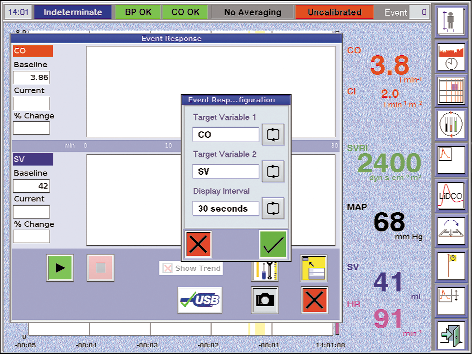 Funzioni delle schermate PulseCO di LiDCOplus 3.2.8 Risposta evento Premere per avviare la funzione Risposta evento.