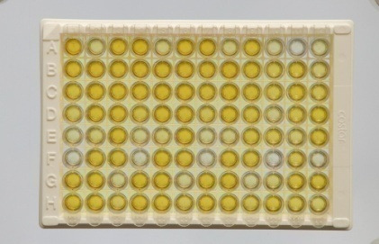 Saggi ELISA Test rapidi immunocromatografici Su quali campioni biologici?