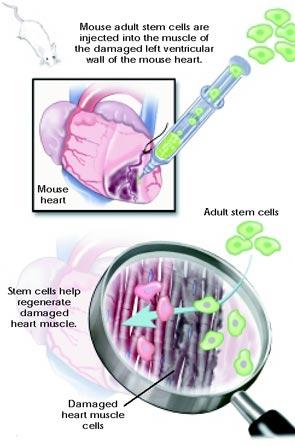 Riparo del muscolo cardiaco per mezzo di cellule staminali adulte Cellule staminali adulte del topo vengono iniettate direttamente nel muscolo