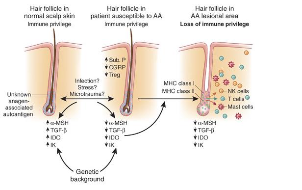 ANALISI DEI GENI ICOSL FOXP3 e ICOS, IN PAZIENTI AFFETTI DA ALOPECIA AREATA L alopecia areata (AA) è una comune malattia della pelle che si manifesta con la perdita dei capelli e affligge