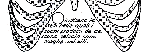 A P 2 TONO (S2) Coincide con fine sistole ventricolare.