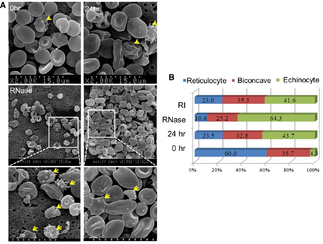 RNA RETICOLOCITARIO E