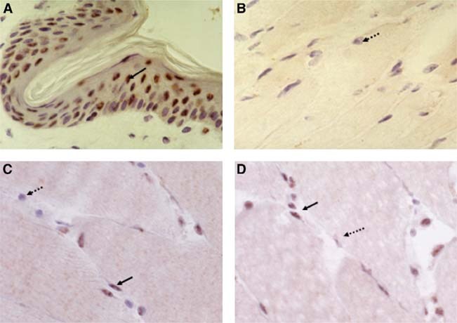 Human skeletal muscle express VDR Regulation of calcium transport Uptake of inorganic phosphate for production of energy-rich