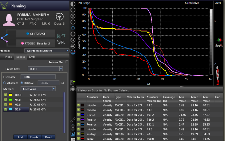 valutare i constraints di dose OAR :