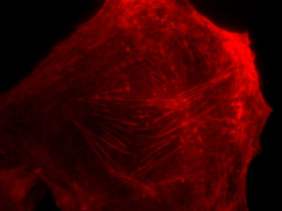 Sulla sinistra è riportata l immagine ottica di una cellula di osteosarcoma fluorescente.