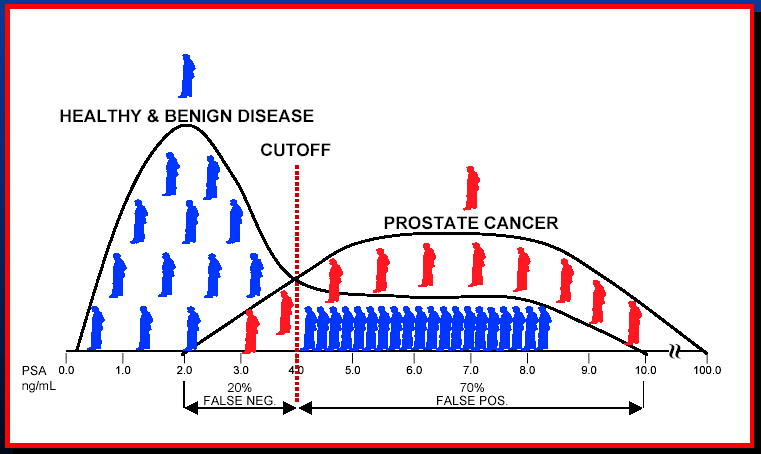 CARCINOMA