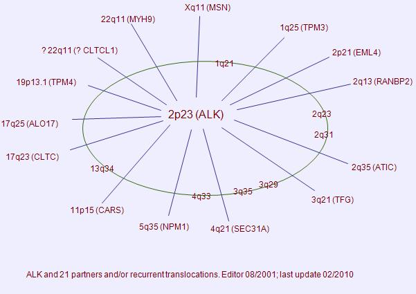 Anaplastic large cell lymphoma (ALCL), anaplastic lymphoma kinase