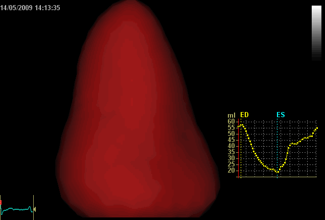 3 D MODALITA DI VISUALIZZAZIONE 1.