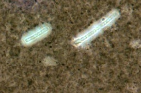 Bacterial capsules visualized by various techniques Left. Streptococcus pneumoniae -India ink (A black pigment) capsule outline ; S. pneumoniae capsular material is composed of polysaccharide.