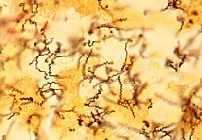 Colorazione spirochete Borrelia osservata al mo in campo oscuro Treponema pallidum, the spirochete that causes syphilis. Silver stain. CDC. Due spirochete al microscopio a fluorescenza.