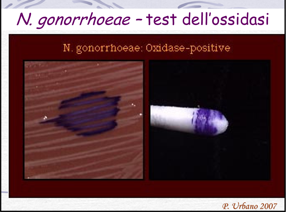 TEST dell OSSIDASI un altro enzima respiratorio utilizzato spesso per l identificazione di specie di Neisseria e Pseudomonas è l OSSIDASI, questo enzima è in grado di ossidare ammine-aromatiche con