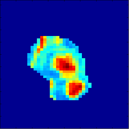 4. Il Modulo BioOPT 57 pixel.