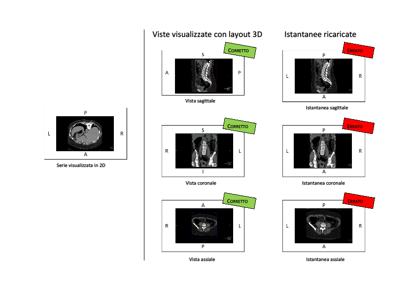 Fig. 1: Serie prona Scenario 2: Caricare una serie supina e fare un'istantanea del