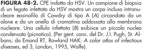 corpi del Negri (Rhabdovirus) inclusioni di Cowdry di tipo A (Herpesvirus,