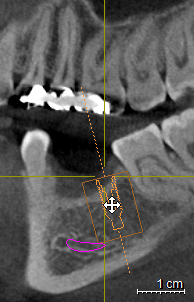 6. Inserimento/elaborazione degli impianti 6.4.