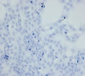 Cell-based bioassay e micotossine Cell lines OTA LC50 (µg/ml) 24 h 48 h SK-N-MC (human