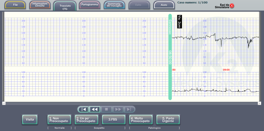 Finestra del tracciato CTG Facendo clic sulla scheda Tracciato CTG appare la finestra Tracciato CTG (Figura 19: questa è la finestra di default del simulatore): Figura 19 il tracciato CTG nel