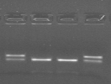 E stata utilizzata la Taq MAXIMA HOT START DNA POLYMERASE della ditta FERMENTAS, la reazione è stata effettuata in 25µL totali.