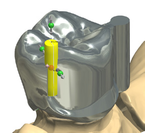 Allegati parametrici Una nuova funzione flessibile che rende possibile adattare più allegati alla situazione clinica specifica.