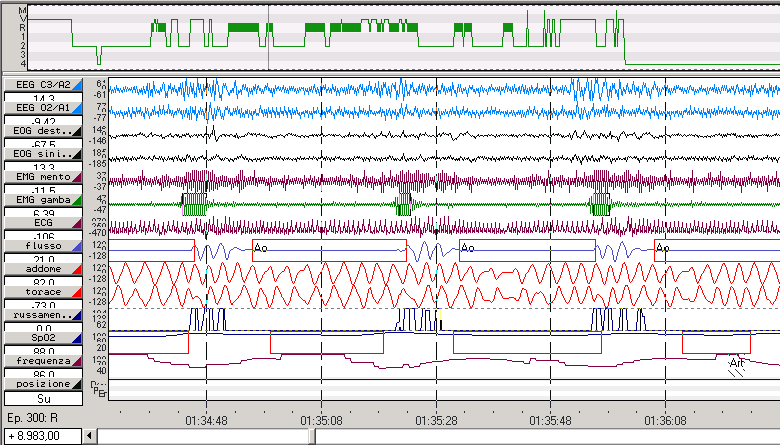 2 min