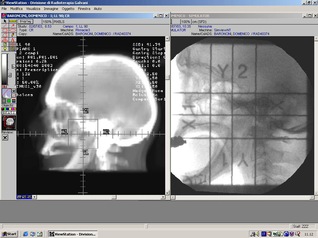 Esempio di Imaging Workflow Simulazione Tradizionale Posizionamento Simulatore