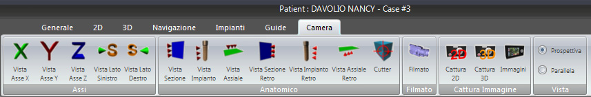 I bottoni presenti in questa scheda consentono di posizionare la camera che mostra il modello 3D in