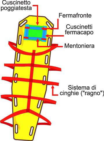 .) Compatibilità con Raggi X, TAC, Risonanza magnetica Pratica, robusta e versatile, può essere usata nelle situazioni più diverse Per contro, essa risulta poco tollerata per il suo sistema