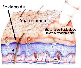 CARATTERISTICHE: non lascia segni non presenta controindicazioni è totalmente indolore può essere eseguita in tutti i periodi dell'anno Viene utilizzata per combattere la cellulite, le rughe, le