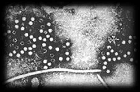 Epatite E Virus non classificati (HEV) Sintomi e decorso (±) come HAV* Età a rischio: