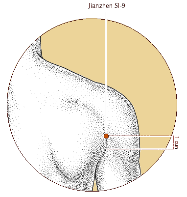 SI 9 - Jiān Zhēn (VERTICALE DELLA SPALLA) Jiān (Ricci 745): spalla Zhēn (Ricci 285): divinazione, giusto, virtuoso a braccio addotto, sulla linea ascellare posteriore, 1 cùn sopra la plica ascellare.