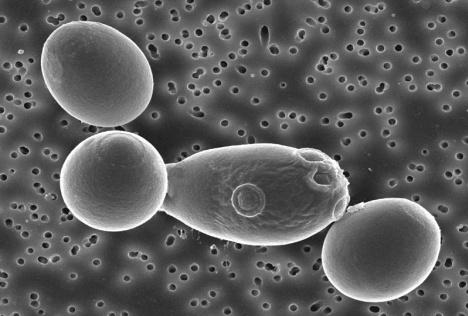 I probiotici con batteri lattici e i bifidobatteri contengono: Batteri lattici Bifidobatteri L. acidophilus B. longum L. casei B. breve L. delbrueckii subsp. bulgaricus B.