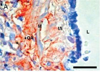 Decreased decorin content in small airways in