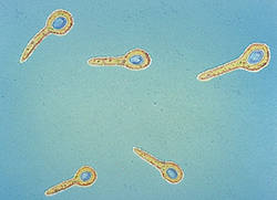 I clostridi: batteri sporigeni Sono bacilli Gram positivi di 3-8 mm di lunghezza In gran parte sono mobili
