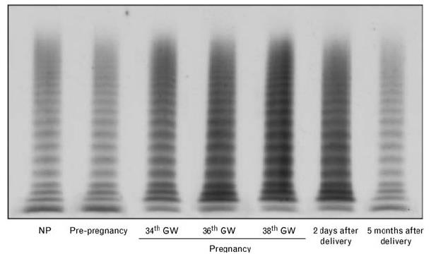 Polimorfismo del promotore del VWF: haplotype 2 che protegge contro l'aumento del VWF indotto dal cortisolo