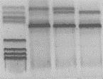 dntp, 0,5µl di primer FI-1 e 0,5µl di primer RI-1, 1µl di primer RO-1 e 1µl di primer FO-1, 30,8µl di H 2 O e 0,2µl di AmpliTaq Gold DNA polymerase.
