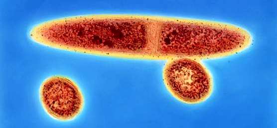 RISCHIO BIOLOGICO : agenti biologici - definizioni Batteri: replicazione autonoma (scissione binaria) BATTERI: organismi unicellulari Procarioti, di dimensioni dell'ordine dei micron, senza membrana