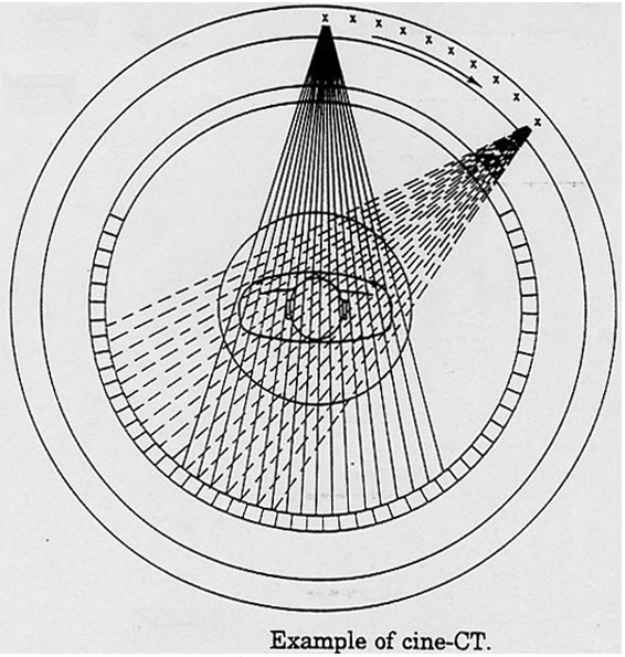 Nella seconda generazione il movimento della sorgente e del detector e simile a quello della prima generazione con traslazione e rotazione. La differenza sta nel detector che e multiplo.